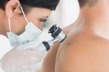 Melanoma Cancer: Prevention &amp; Treatment