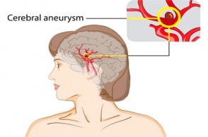 The Headache You Can’t & Shouldn't Ignore