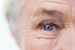 Age-Related Macular Degeneration