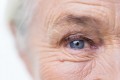 Age-Related Macular Degeneration