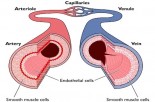 Keys to Reversing Vascular Risk Factors