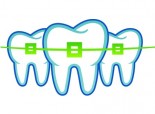 Adult Braces vs. Invisalign: What&#039;s Right for You?