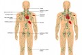 Lymphatics & Chronic Diseases