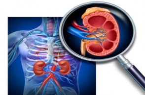 Prevent Kidney Disease