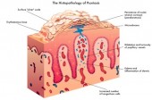 Ask Dr. Mike: Alternative Treatments for Psoriasis PLUS How Do Biologics Work?